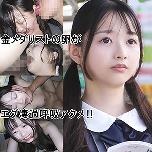 IBちゃん（仮名）【ゆず故障】 望月つぼみ